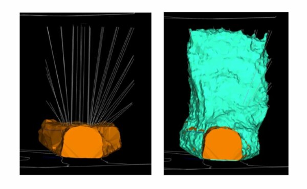 What is Double Layer Blind Blast (DLBB) ?